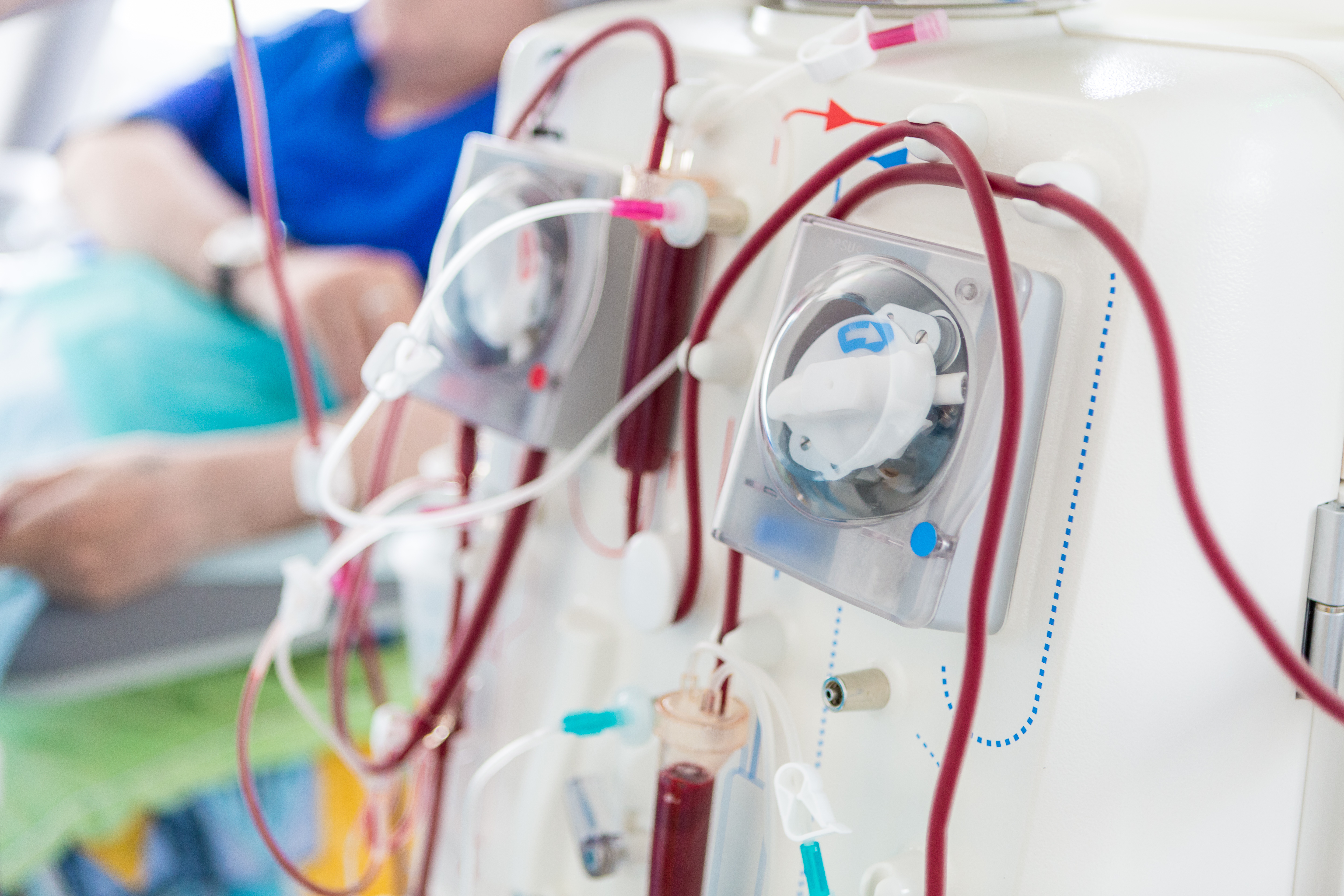 The front of a dialysis machine is seen in the foreground as it cycles the blood of a patient.