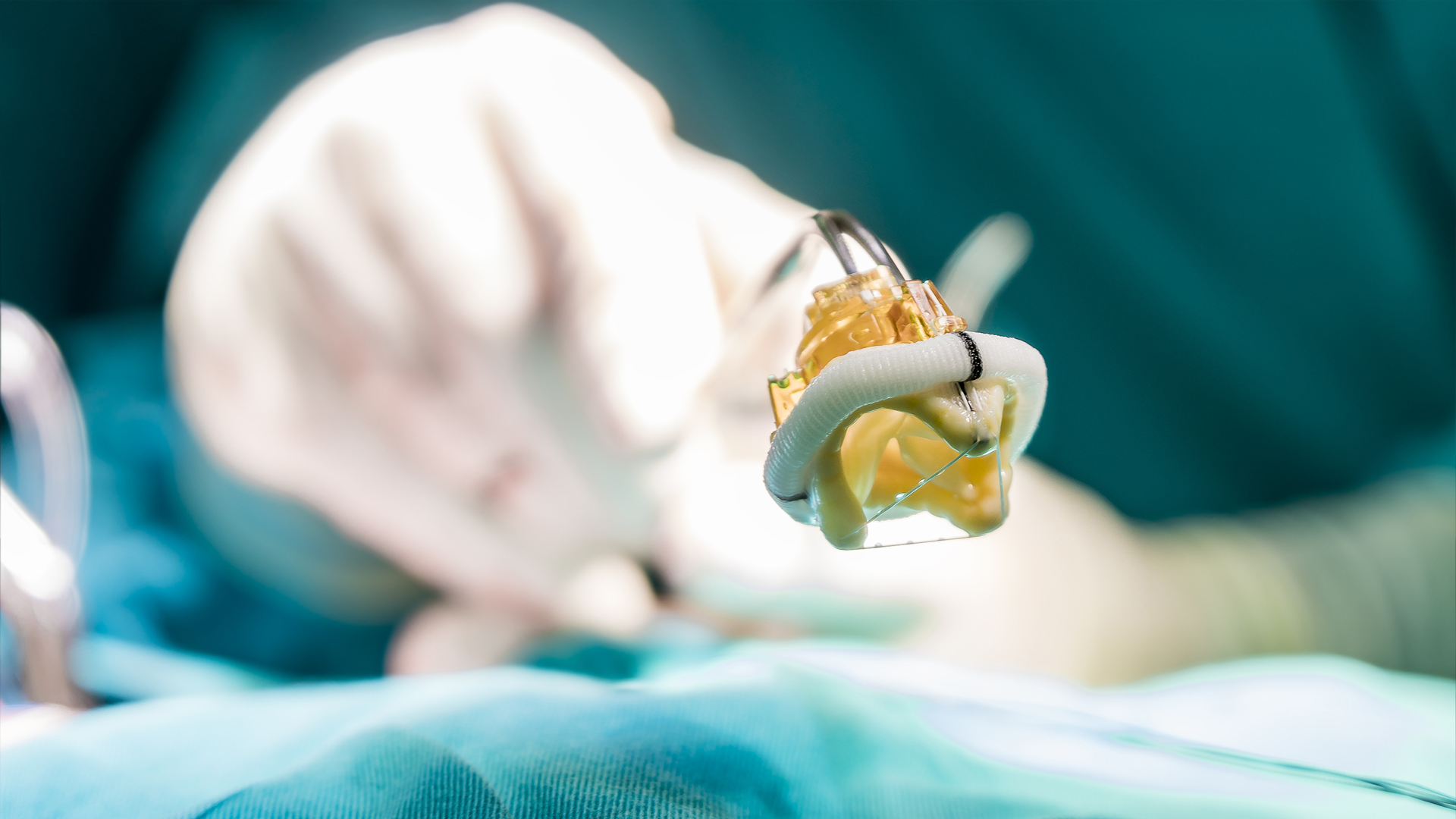 HeartImplant_297303919 A surgeon holds aortic valve, an artificial heart prosthesis the size of a golf ball.