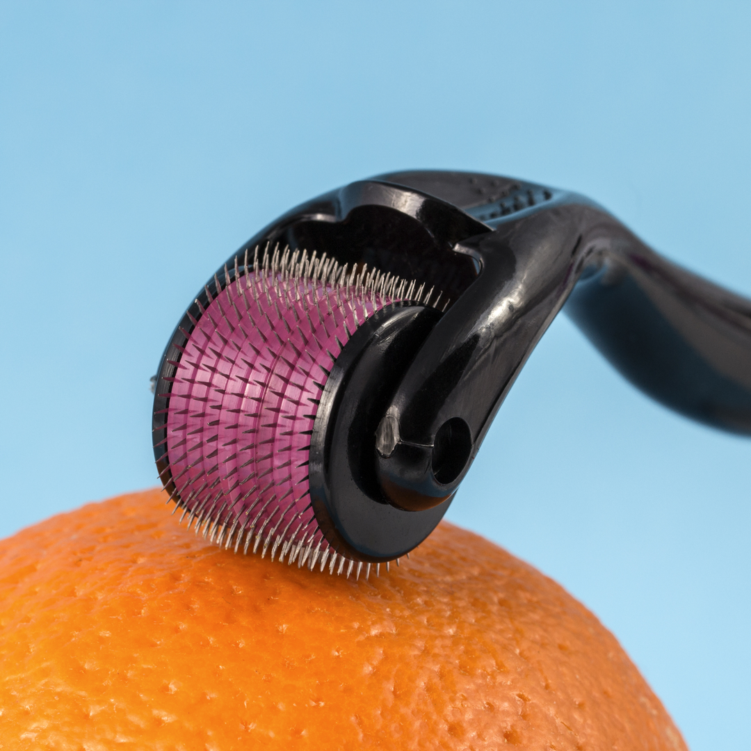 A hand held roller surfaced with tiny needles is rolled across an orange peel.